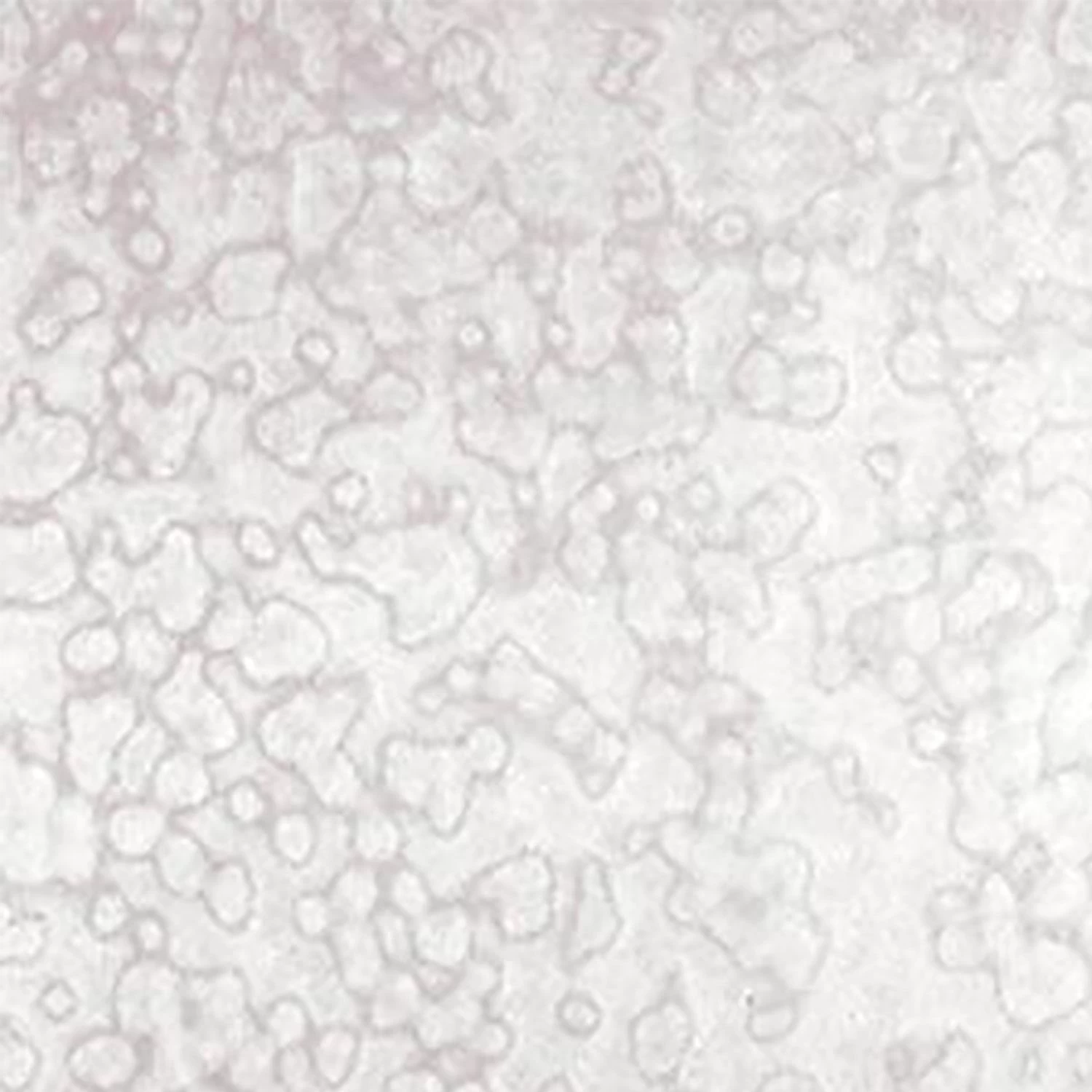 Uro White Ring Mottle 1 Uro White Ring Mottle